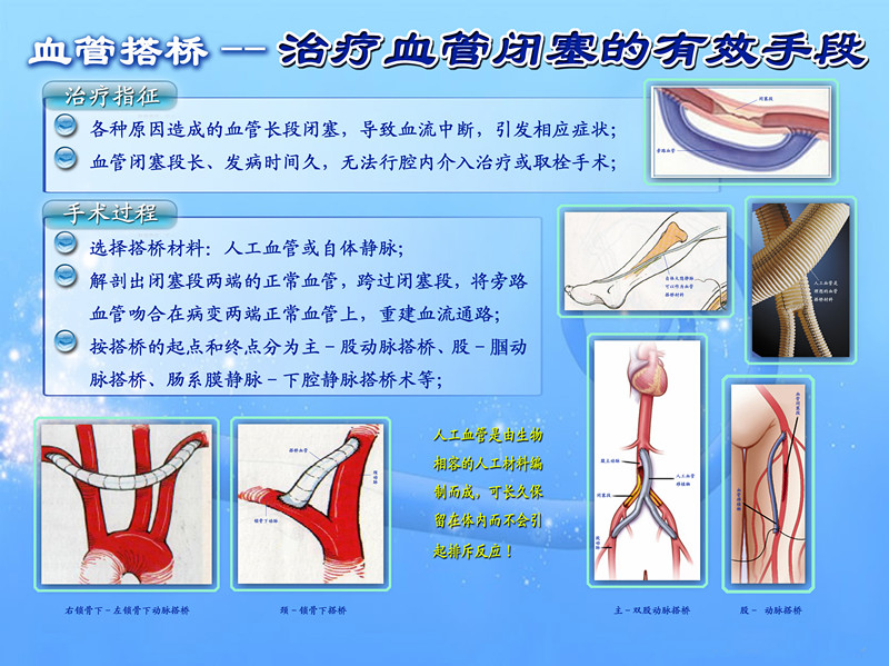 血管外科_血管脂肪瘤_血管外科收入
