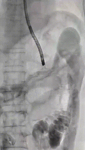 7a6bd7e790df71dbbb5e162eabcc618c~1.gif