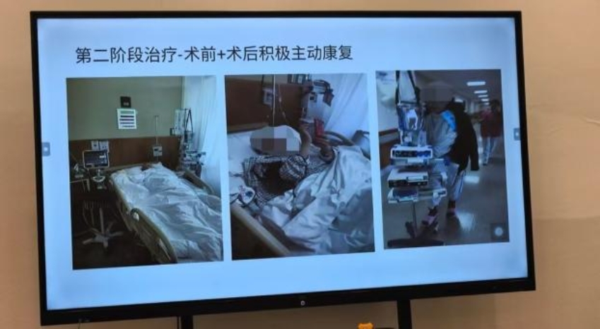 脱下白衣直面癌症 重披战袍照亮他人