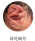 blob.png