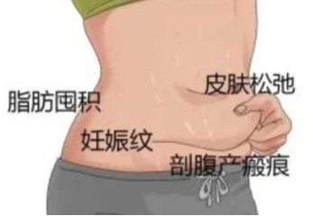 blob.png