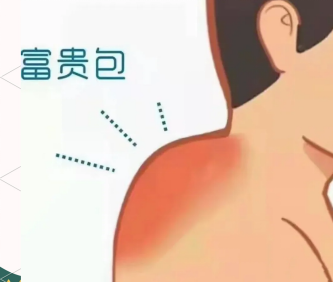 blob.png