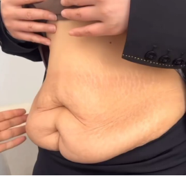blob.png