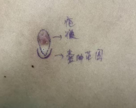 blob.png