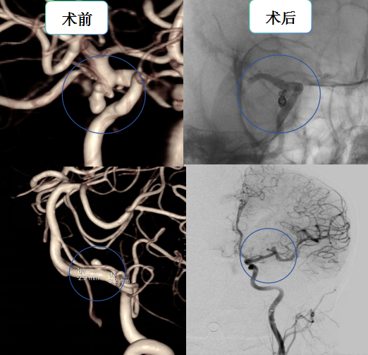 图片333.png