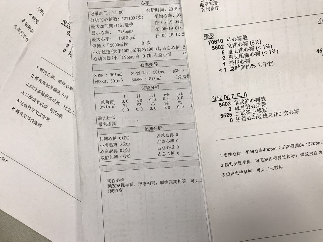 心脏起搏器心电图报告图片