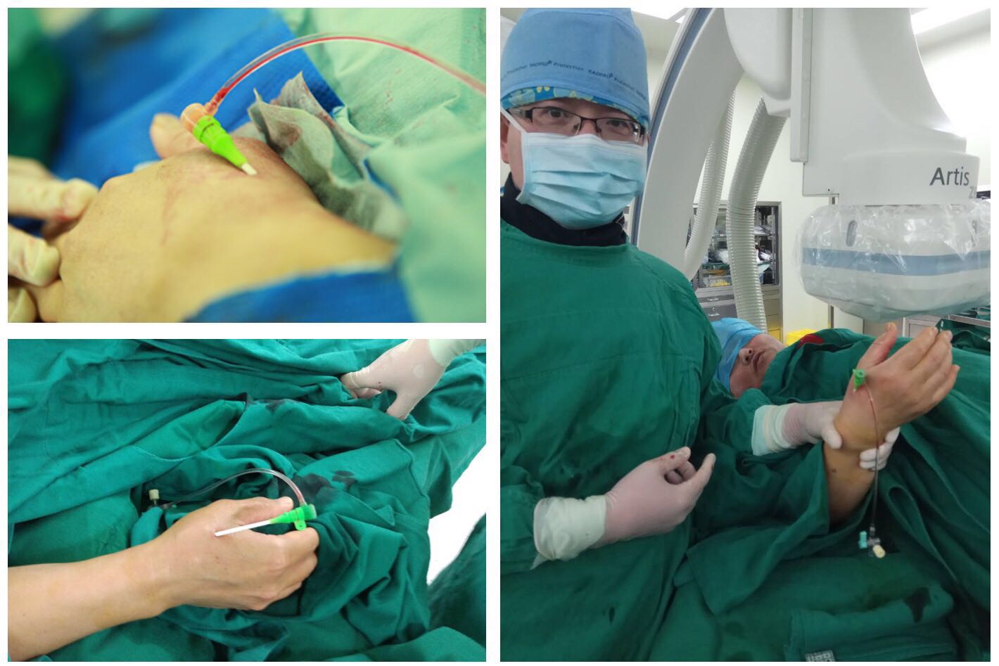 宁远县人民医院成功完成首例B超引导下经外周静脉穿刺置管术 - 永州 - 新湖南