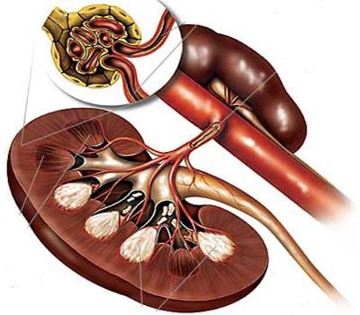 高血压难控制要警惕肾动脉狭窄