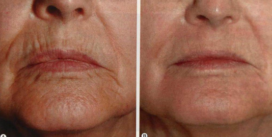 虚假美容广告愿你从此不再受骗